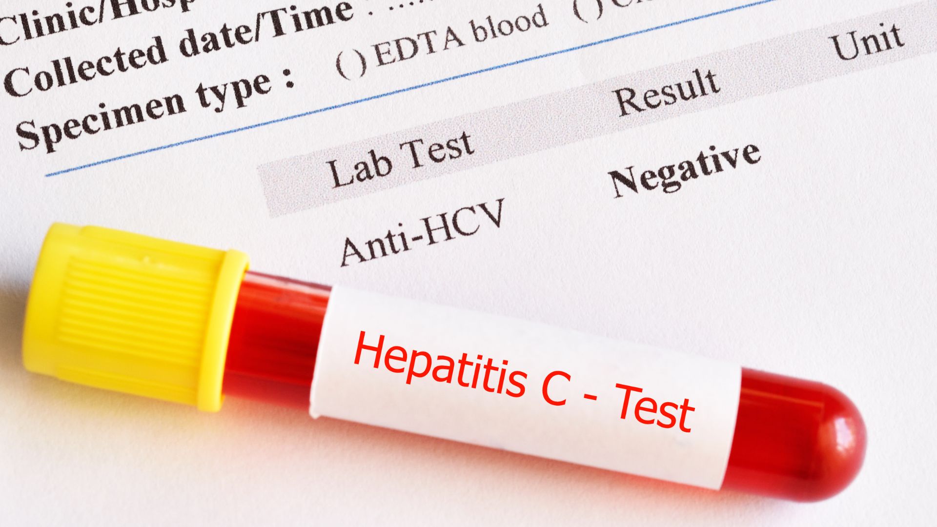 Ống máu ghi nhãn "Hepatitis C - Test" trên phiếu kết quả Anti-HCV âm tính
