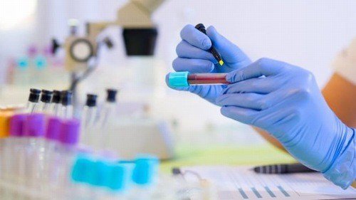 Xét nghiệm PTH và những điều cần biết