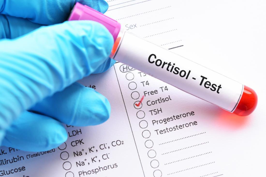 Một xét nghiệm định lượng cortisol trong máu giúp chẩn đoán các rối loạn chức năng của tuyến thượng thận