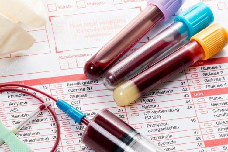 Các xét nghiệm cần chỉ định thực hiện nhằm đánh giá chức năng Thận