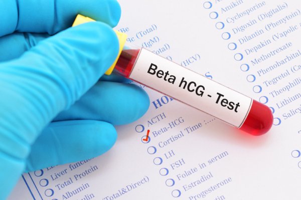Xét nghiệm Beta hCG và những chỉ số ý nghĩa trong thai kỳ thường được Y Bác sĩ lưu ý?