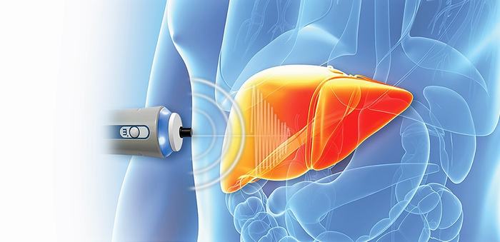 Những xét nghiệm và cận lâm sàng cần thiết khi đi khám sức khỏe định kỳ