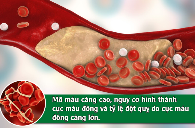 Hình minh họa mảng mỡ trong lòng mạch kèm chú thích: mỡ máu càng cao, nguy cơ hình thành cục máu đông và đột quỵ càng lớn