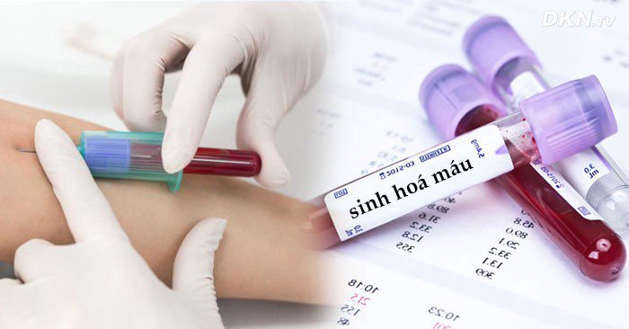 Lấy máu tĩnh mạch và các ống mẫu ghi nhãn "sinh hoá máu"