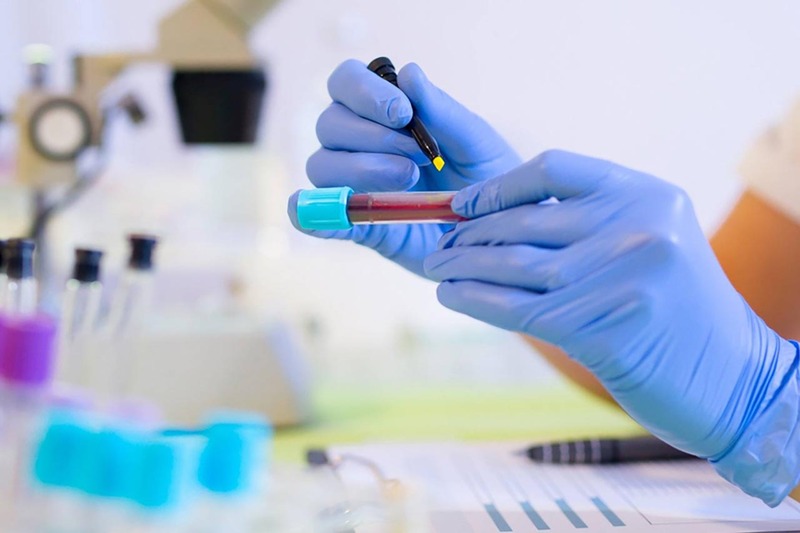 Kỹ thuật viên đeo găng ghi nhãn ống mẫu máu